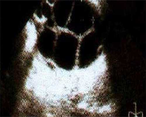 广州代怀供卵代生孩子，广州试管代生那家医院正规？