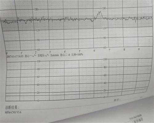 染色体不好能做试管婴儿吗,染色体异常能做试管婴儿吗