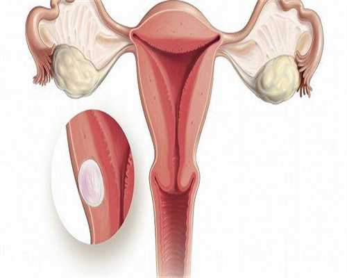代孕宝宝地址-移植前宫腔粘连，内膜剥离手术对移植的影响真的很大？