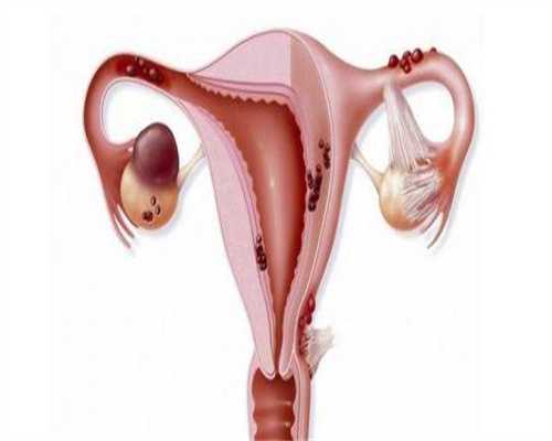 广东代孕中心有几家-广东中山试管代孕中心