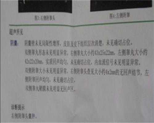 代孕机构哪里最安全_国内医院哪有供卵,第三代试管婴儿近视会遗传吗？三代试