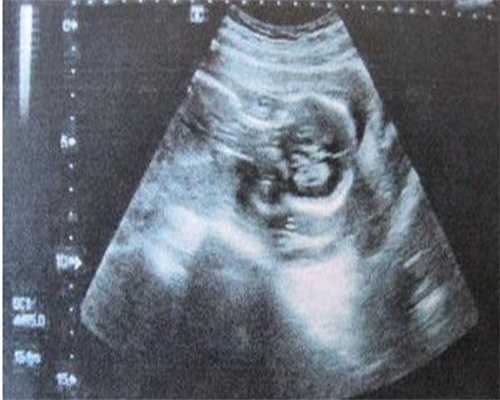 广东有代孕公司吗，广东供卵试管小孩哪里公司好？2026广东试管婴儿费用明细