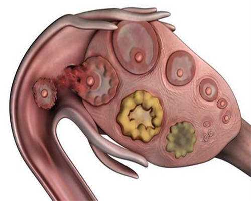 广州哪里做试管包男孩，广州试管成功率高的私立医院