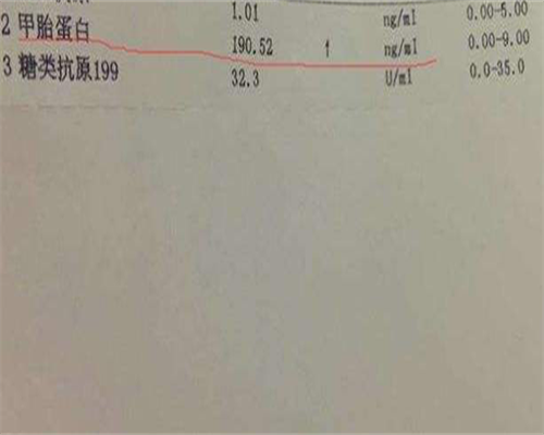 代怀孕网费用：广州佛山试管婴儿那里最好的医院